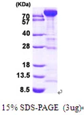 Human PFKM protein, His tag. GTX67627-pro