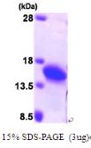 Human Profilin 2 protein, His tag. GTX67629-pro
