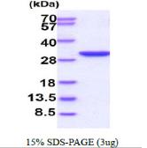 Human PGAM2 protein, His tag. GTX67631-pro