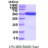 Human PGD protein, His tag. GTX67632-pro