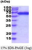 Human PGM1 protein, His tag. GTX67635-pro
