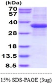 Human Prohibitin protein, His tag. GTX67636-pro