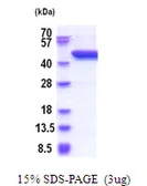 Human SerpinB8 protein, His tag. GTX67637-pro