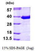 Human PITPN / PITP alpha protein, His tag. GTX67638-pro
