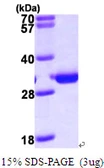 Human PMM2 protein, His tag. GTX67641-pro