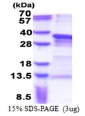 Human PRRX1 protein, His tag. GTX67643-pro