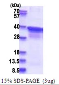 Human POLR2C protein, His tag. GTX67647-pro
