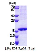 Human POLR2D protein, His tag. GTX67648-pro