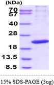Human RPB8 protein, His tag. GTX67651-pro