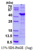 Human NIPP1 protein, His tag. GTX67662-pro