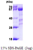 Human Calcineurin A protein, His tag. GTX67664-pro