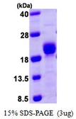 Human Calcineurin B protein, His tag. GTX67666-pro