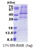 Human AMPK gamma 1 protein, His tag. GTX67673-pro