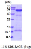 Human PKA R2 protein, His tag. GTX67674-pro