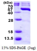 Human p38 beta protein, His tag. GTX67678-pro