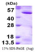 Human MEK2 protein, His tag. GTX67683-pro
