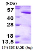 Human MEK2 protein, His tag. GTX67683-pro