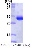 Human Proteasome 20S alpha 1 protein, His tag. GTX67689-pro