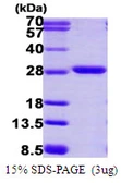 Human Proteasome 20S alpha 2 protein, His tag. GTX67690-pro