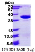 Human PSMA4 protein, His tag. GTX67692-pro