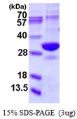 Human PSMA5 protein, His tag. GTX67693-pro