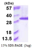 Human PSMA6 protein, His tag. GTX67694-pro