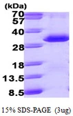 Human PSME1 protein, His tag. GTX67703-pro