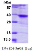 Human PTK9 protein, His tag. GTX67707-pro