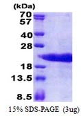 Human PTMA protein, His tag. GTX67708-pro