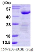 Human PTPN7 protein, His tag. GTX67710-pro