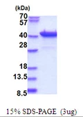 Human PURB protein, His tag. GTX67714-pro