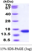 Human Parvalbumin protein, His tag. GTX67715-pro