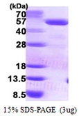 Human PCYT2 protein, His tag. GTX67716-pro