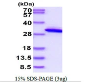 Human QDPR protein, His tag. GTX67718-pro