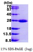 Human Rab 1A protein, His tag. GTX67719-pro
