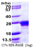Human RAB2A protein, His tag. GTX67720-pro