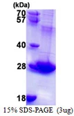 Human RAB3B protein, His tag. GTX67722-pro