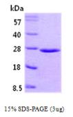 Human RAB5A protein. GTX67725-pro