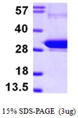Human Rab5b protein, His tag. GTX67726-pro