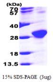 Human RAB6A protein, His tag. GTX67727-pro