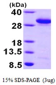 Human RAB27A protein, His tag. GTX67728-pro