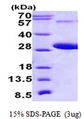 Human RAB5C protein, His tag. GTX67731-pro
