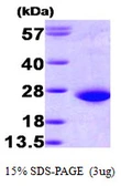 Human RAC1 protein, His tag. GTX67733-pro