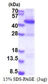 Human Rad51B protein, His tag. GTX67735-pro