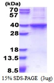 Human Rad51D protein, His tag. GTX67736-pro