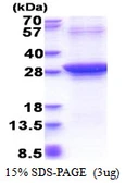 Human Rad51D protein, His tag. GTX67737-pro