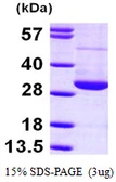 Human RAN protein, His tag. GTX67738-pro