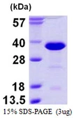 Human RanBP1 protein, His tag. GTX67739-pro