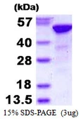 Human RbAp48 protein, His tag. GTX67741-pro