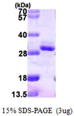 Human RGS2 protein, His tag. GTX67747-pro